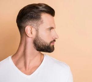 Prótese de cabelo masculino 3